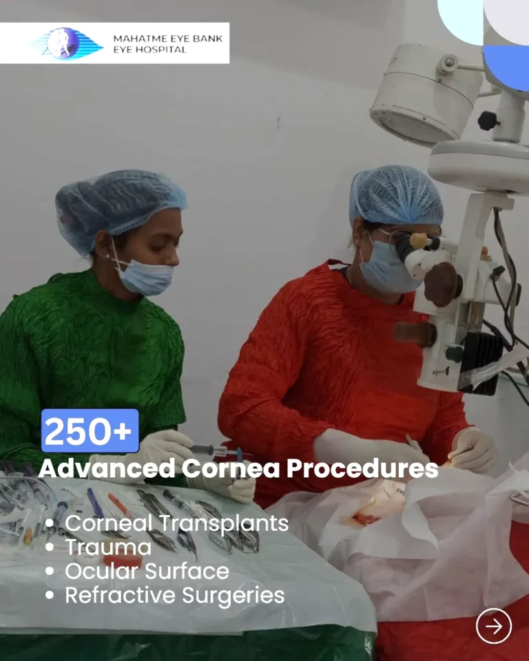 cornea-img-2
